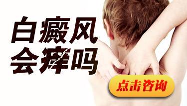 照光后边界清晰，白癜风微痒是什么表现
