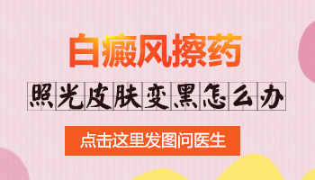 白癜风映照308后可以碰水吗