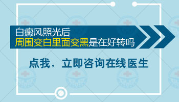 308激光治疗多久一次