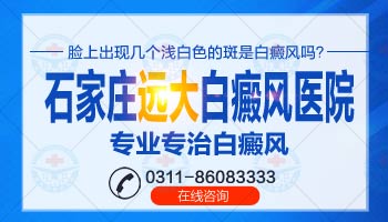 白癜风早期用308激光好吗相关引荐