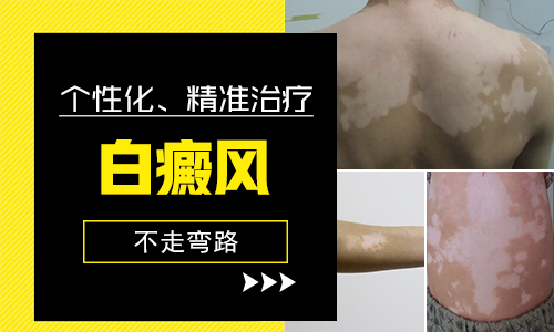 308治疗白斑