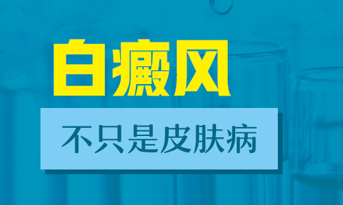 白癜风308能天天照吗