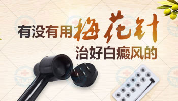 白癜风308激光好还是植皮好