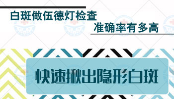 308白癜风治疗多久能治好