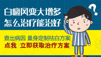 脸上白癜风可以用308激光吗