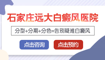 三甲医院做白癜风ct价格是多少