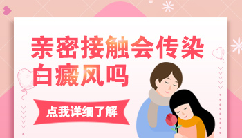 白癜风会传染旁人吗 有白斑都有哪些影响