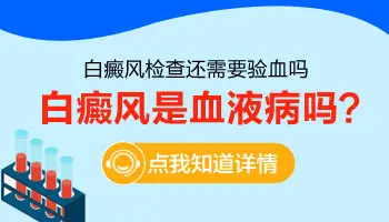 白癜风是血液病么 为什么查血常规