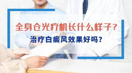 有白癜风还能做理发师吗