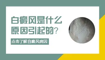 白癜风发病十几天不知道怎么得的