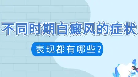 白癜风发病十几天不知道怎么得的