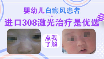 婴幼儿早期白癜风怎么治疗好