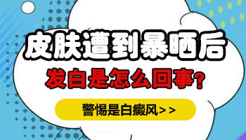 晒伤的皮肤有点白会变成白癜风吗