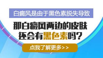 白癜风是身体缺少黑色素导致的吗