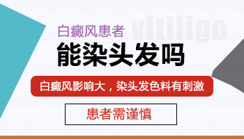 经常做头发会导致白癜风病发吗