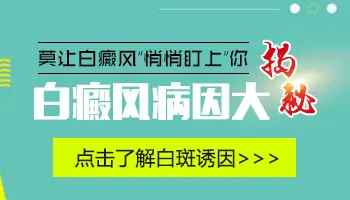 在化工厂上班会不会诱发白癜风