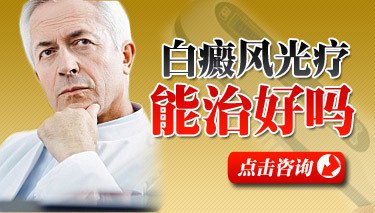 颈部白癜风激光治疗对身体有什么影响