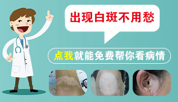 脖子上的白斑发现有一个月了比以前大了