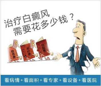 白癜风长脚上应该怎么治