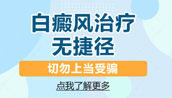 脸蛋上的白癜风用什么方法治疗