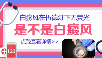 伍德氏灯照脸部白癜风效果怎么样