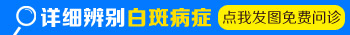 额头上长白斑用什么方法治疗好