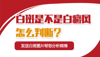 额头上起了块白斑不知道是不是白癜风