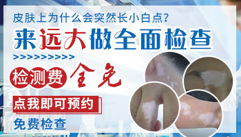 脸上用了面膜后长白斑 白斑是什么