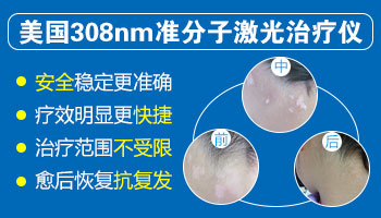 嘴角边上长了块白斑怎么办