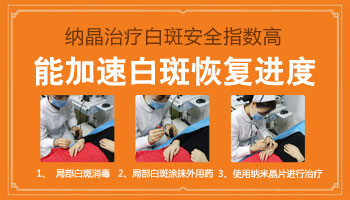 脸上白斑需要照光多少次才能好
