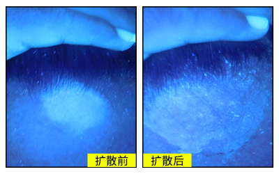 额头白斑出现白点怎么回事