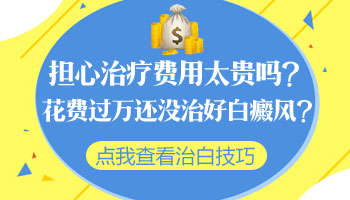 治疗脸上白癜风的费用一共下来大概多少钱