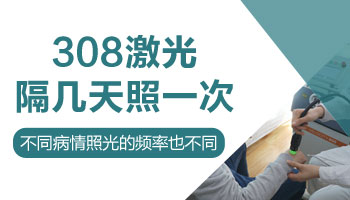 手指白癜风多长时间照一次308激光好