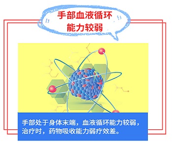 手上有白癜风之前治疗过效果不好