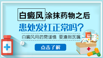 白癜风涂了外用药后手指发红是好是坏