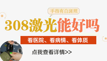 手指白癜风照308效果咋样