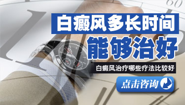 缩短白癜风治疗时间的方式是什么