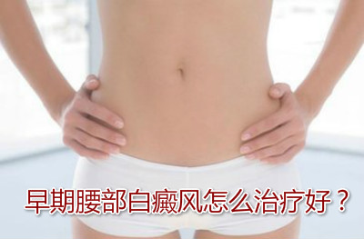 腰部白癜风选择什么样的方法治疗比较好