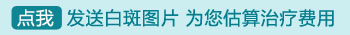 刚出现的白癜风后期会不会长满全身