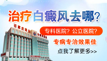 白癜风上夜班怎么保养皮肤