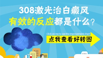 脸部白癜风照完308可以护肤吗