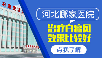 什么样的人身上容易长白癜风