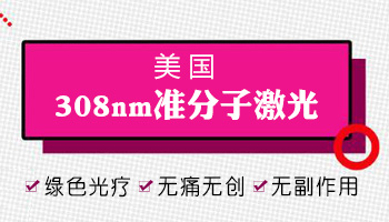 美国308激光和国产308照白癜风的区别