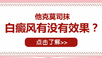 白癜风只涂抹他克莫司管用吗