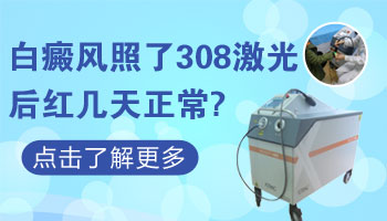 308激光打完白癜风一般红几天