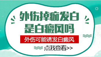 皮肤受伤后会发白吗 如何判断白皮肤是不是白癜风