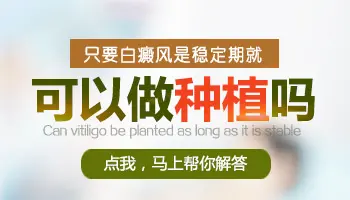 小孩稳定期白癜风能做黑色素种植吗