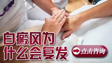 脸上长了白癜风是机缘巧合么