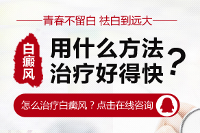 白癜风控制不住用什么激素药好