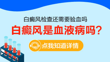 通过血液能不能查出白癜风